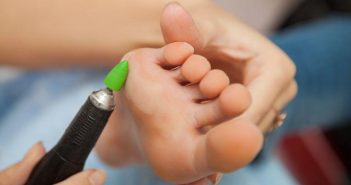 Comment enlever un cor au pied naturellement ?